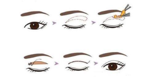 诸暨晨熹颜星医疗美容诊所预约挂号方式：