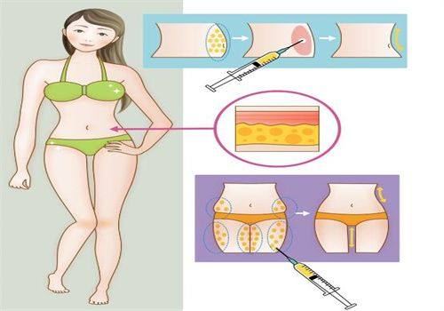 三、不同祛痣方式的留疤风险与适配情况