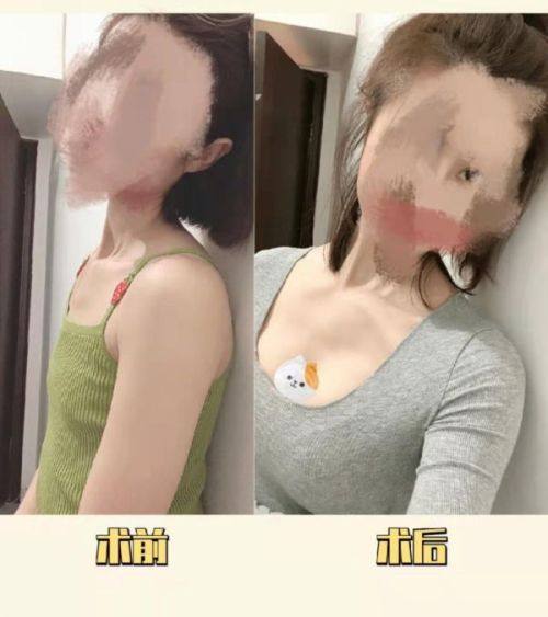 鞍山柏淑桦医疗美容诊所医生名单及擅长领域：