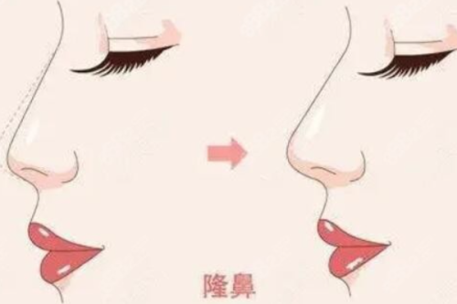 鞍山柏淑桦医疗美容诊所怎么样？