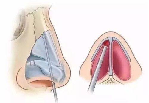 廉江彤雅思医疗美容诊所医生名单及擅长领域