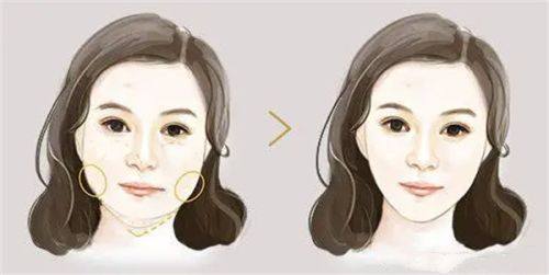 四、中医穴位按摩法：局部+远端协同去眼袋