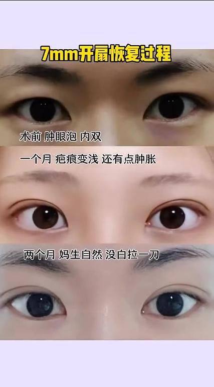 济南蓝石医疗美容诊所擅长项目：