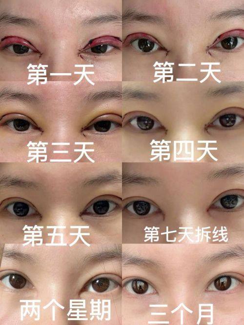 Santiphap医生擅长领域