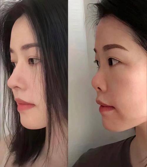 宋晓娟医生技术优势：