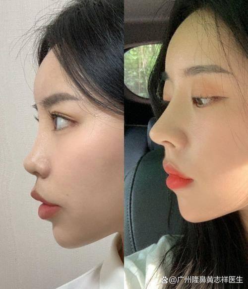 廉江彤雅思医疗美容诊所怎么样