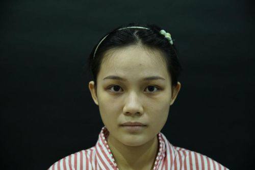 杭州杭西小氧整形医院价格表