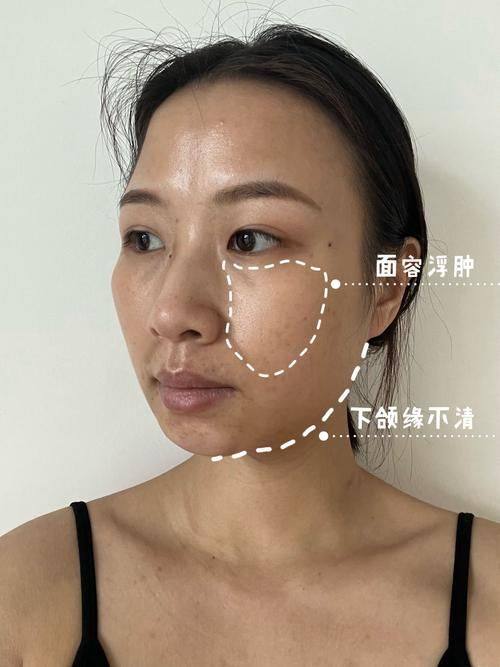 金媛媛医生技术优势