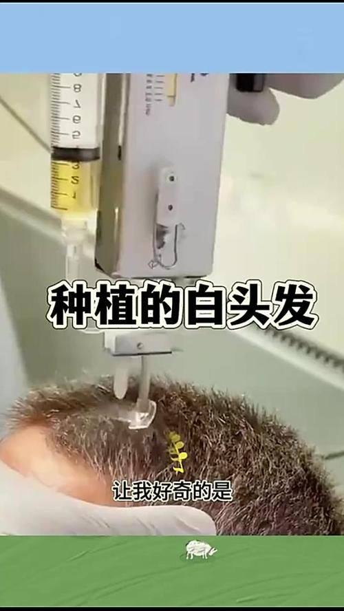 义乌华之美医学美容医院口碑评价