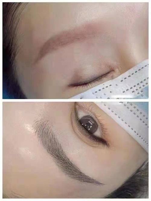 杭州杭西小氧整形医院预约挂号方式