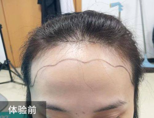 纳帕科伦医生擅长领域