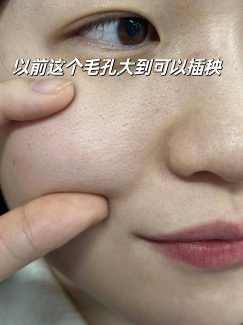 北京品极激光皮肤养护中 心怎么样