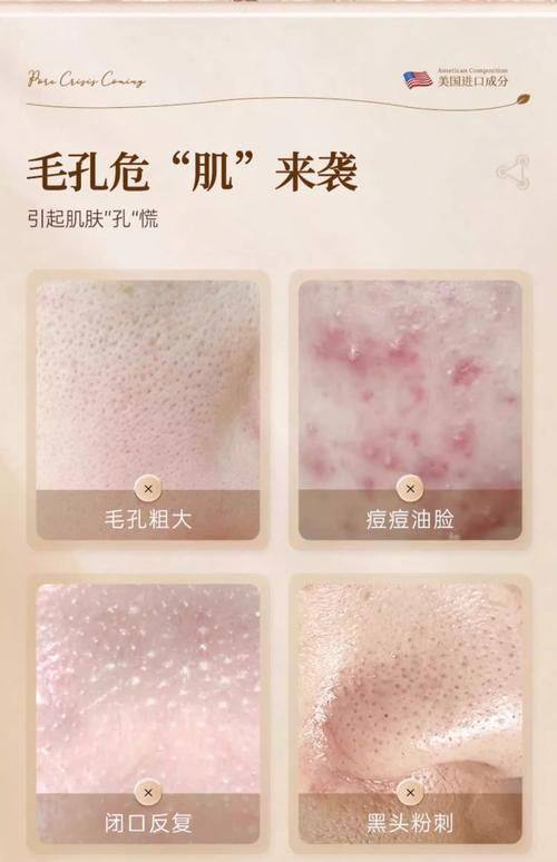 北京品极激光皮肤养护中 心价格表