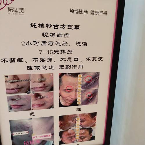 宋晓娟医生怎么预约？