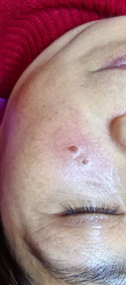 杭州杭西小氧整形医院口碑评价