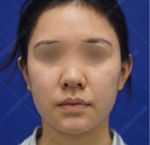 杭州杭西小氧整形医院怎么样？