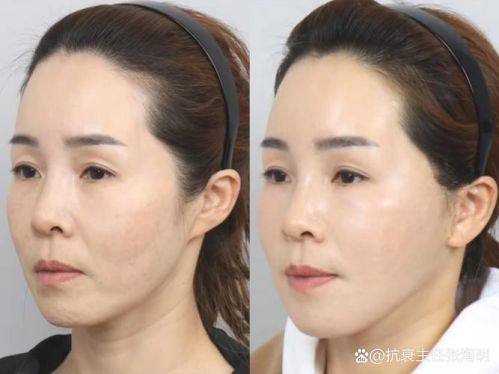 宋秀娥医生怎么预约