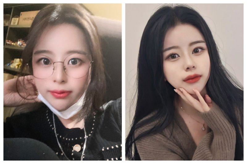 结尾：如何选择适合自己的隆鼻材料