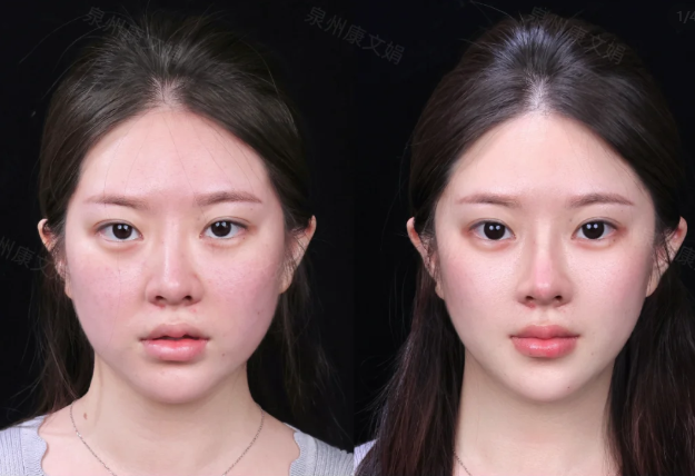 四、长期性价比与返修率分析