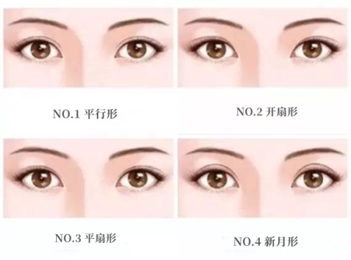 三、取隆胸假体手术后的关键护理要点