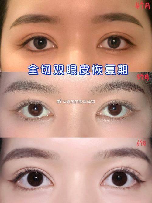 周光杰医生技术优势