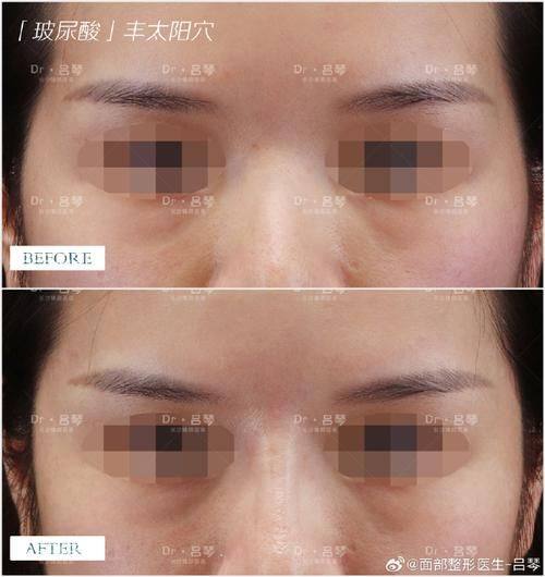 上海锦晖医疗美容门诊部预约挂号方式：