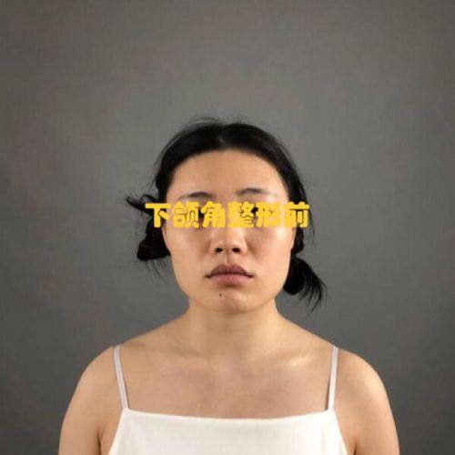 荆门楚伊整形医疗美容怎么样？