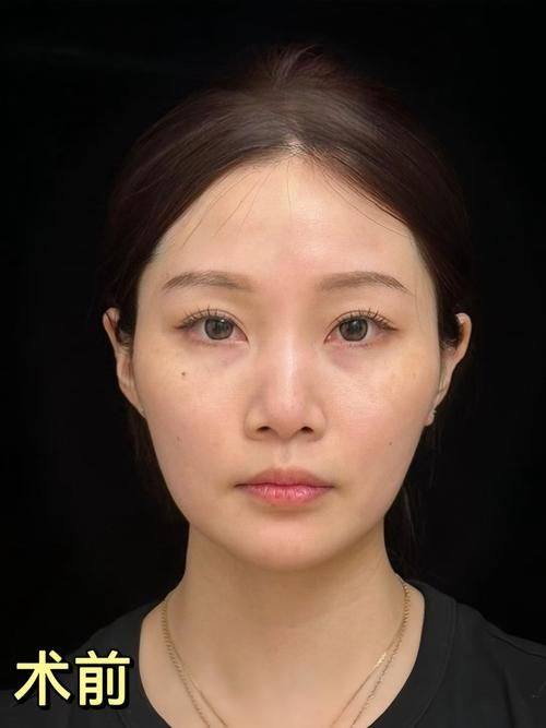 西安英格丽产康(贰捌产康)医疗美容诊所价格表