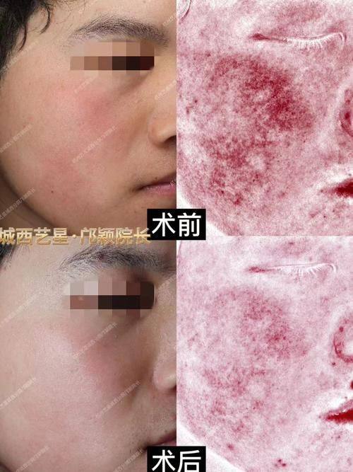 久留米美容外科诊所擅长项目：