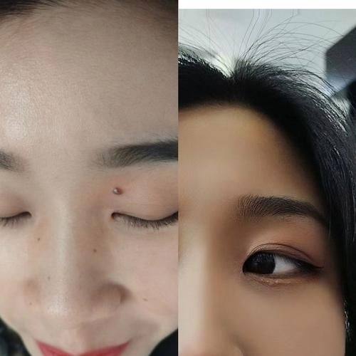 红旗亚星智美医疗美容门诊部预约挂号方式