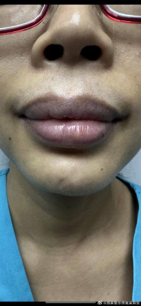 姚容医生怎么预约