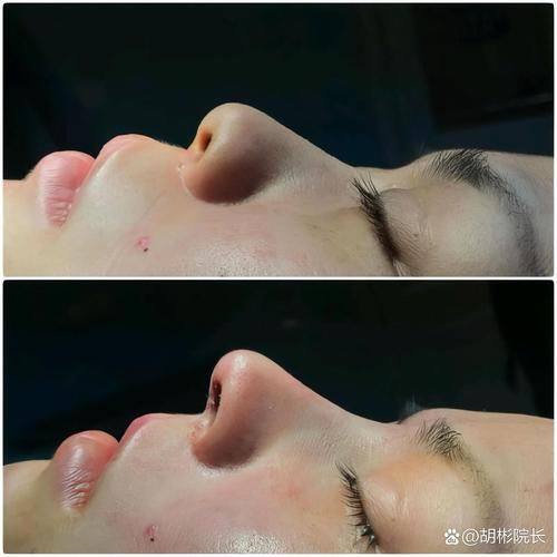 蔡振勇医生技术优势