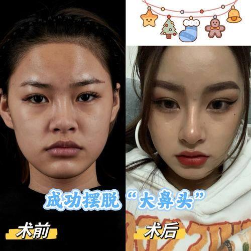 周光杰医生擅长领域