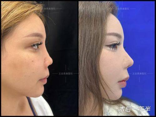 西安英格丽产康(贰捌产康)医疗美容诊所擅长项目