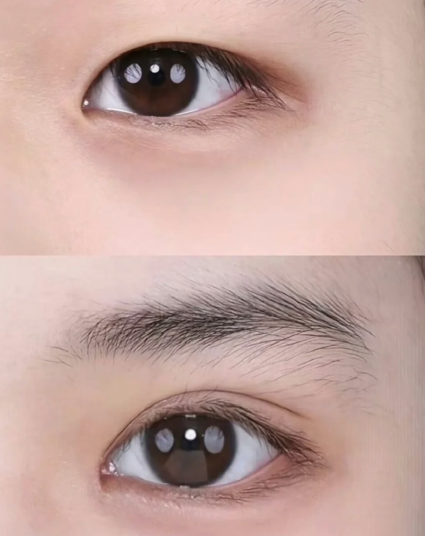 二、眼袋上方叫什么