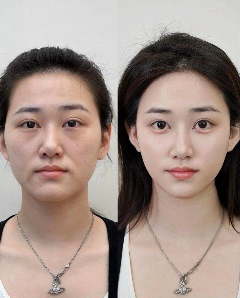 二、影响修复时长的核心因素