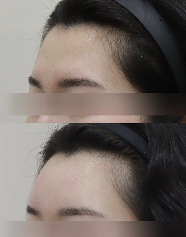 五、真人修复实例参考