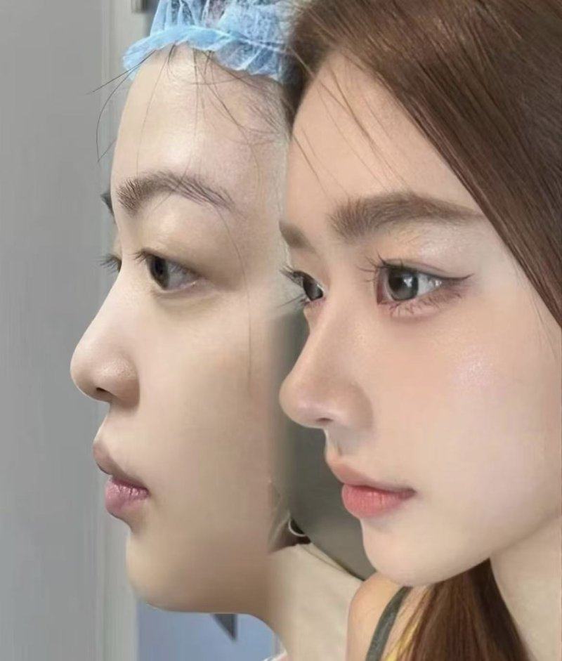 荆门楚伊整形医疗美容医生名单及擅长领域：