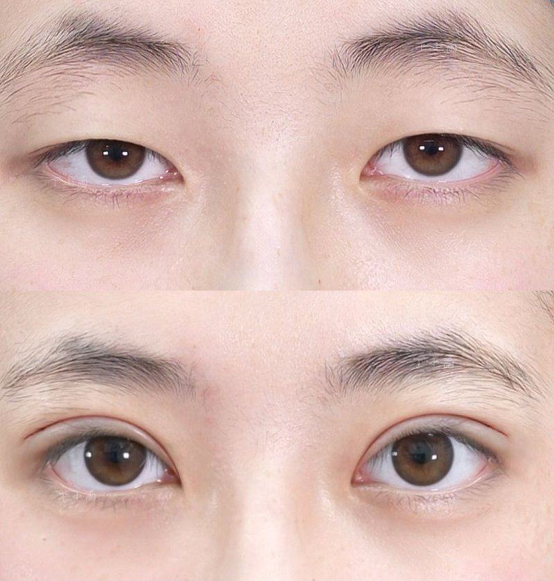 济南颜选医疗美容诊所价格表：