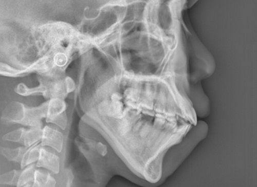 哪几种眼睛不能做双眼皮？眼部基础形态与身体状况常见禁忌大盘点