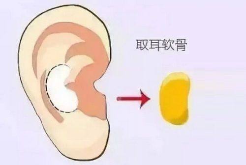 双眼皮能第八天拆线吗？多数术后7天即可拆，恢复慢可调整至8天