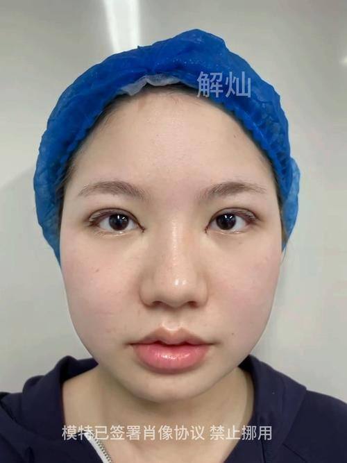 成都高新半山整形医院预约挂号方式：