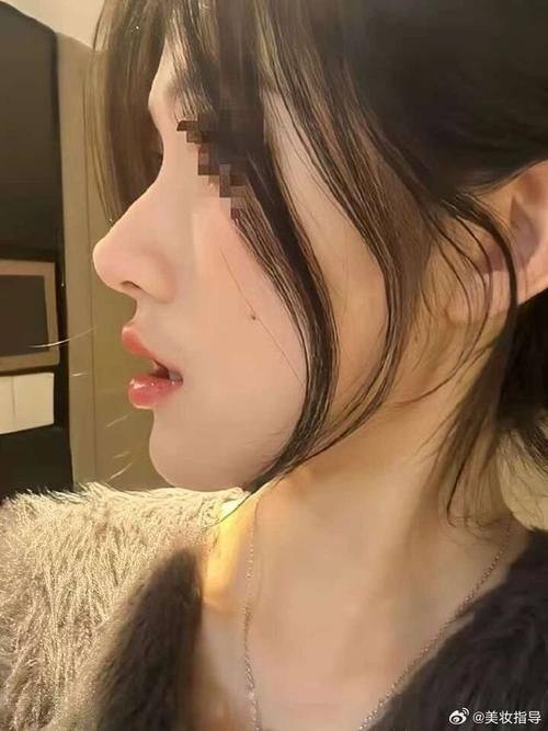 韩国CBK整形外科怎么样