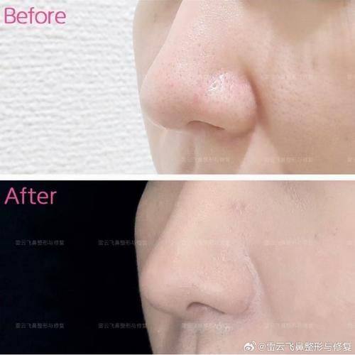 蔡振勇医生口碑评价