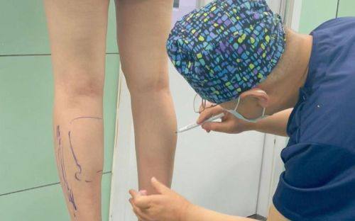 崔敬喜医生技术优势