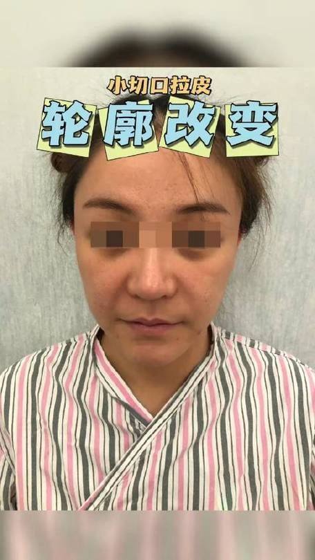 韩国CBK整形外科口碑评价