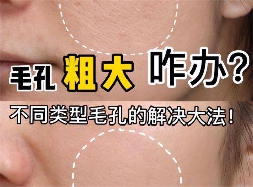 广州氧颜蔻整形医院擅长项目：