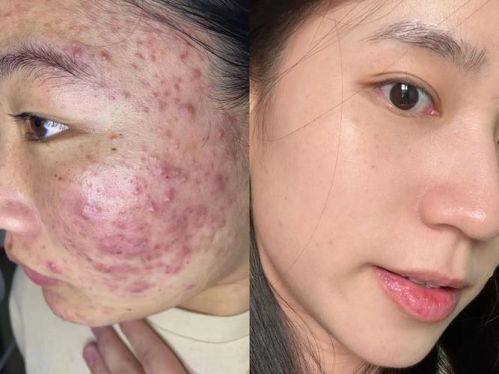 邓飞艳医生怎么预约