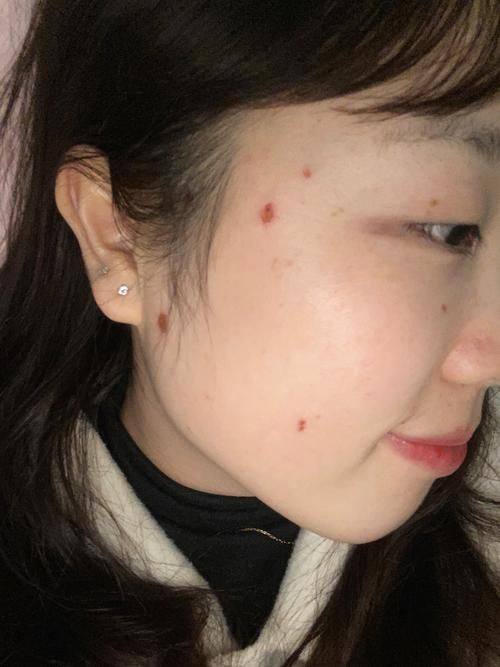 成都利美康爵丽医疗美容整形医院怎么样？