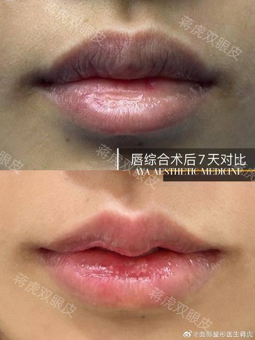 韩国CBK整形外科医生名单及擅长领域：